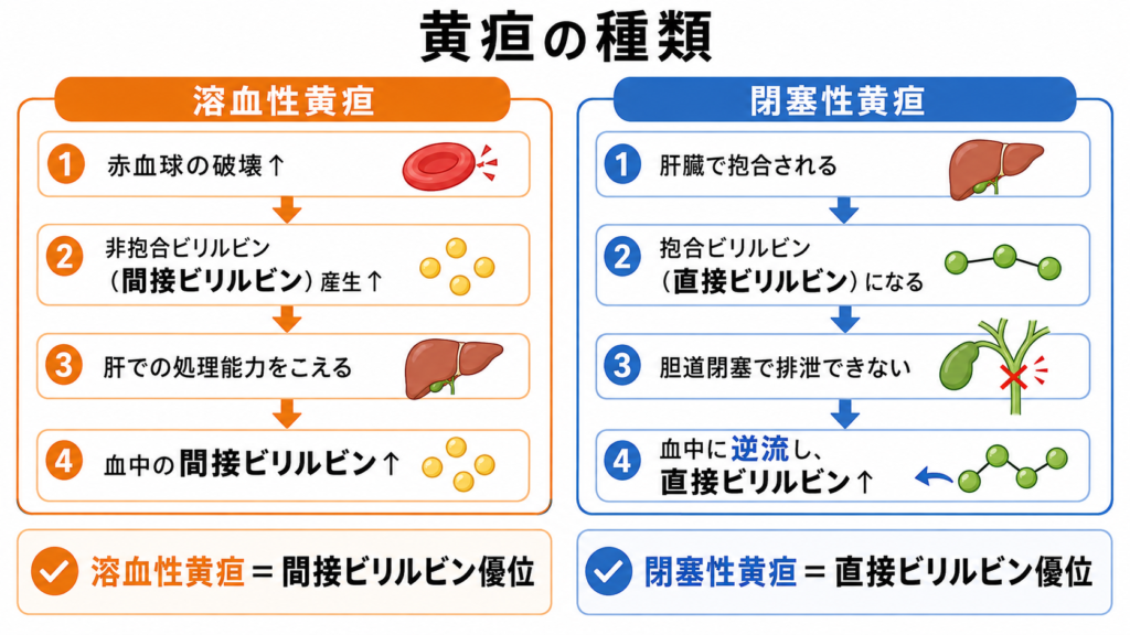 溶血性黄疸と閉塞性黄疸、それぞれの発生メカニズムとビリルビンの型(間接・直接)の違いを示した比較図解